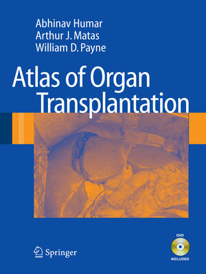 cover image of Atlas of Organ Transplantation